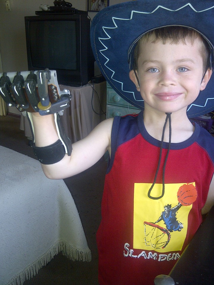 Liam, the first child to get a 3D printed prosthetic e-NABLE hand