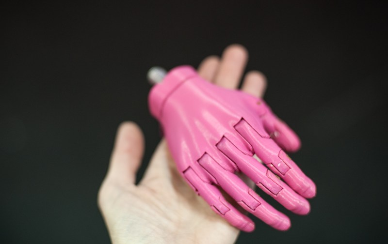 A 3D printed e-NABLE prosthetic hand