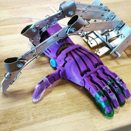 e-nable 3D printed prosthetic with original design